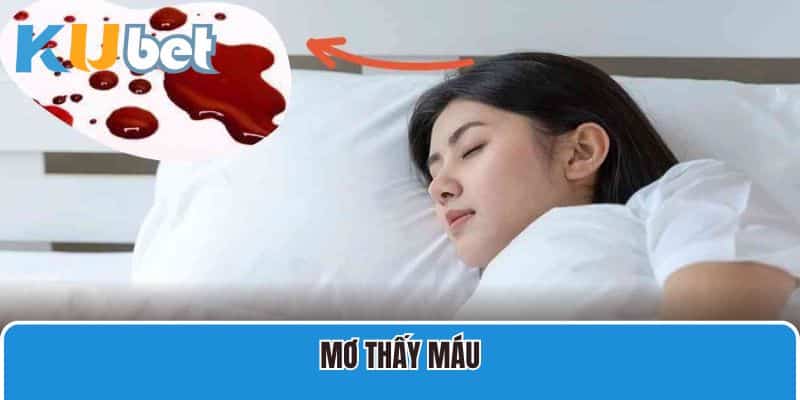 Giải Mã Chi Tiết 8 Giấc Mơ Thấy Máu Cùng Nhà Cái Kubet